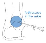 ankle scope