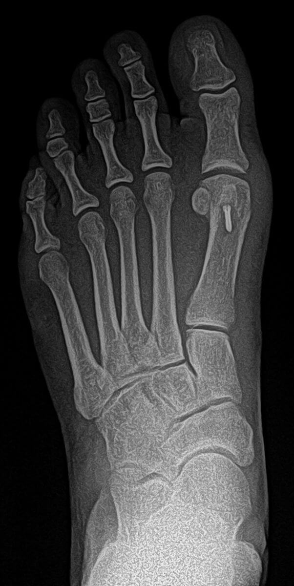 digital xray 1