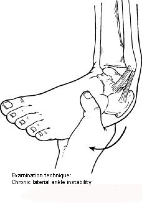 exam unstable ankle 1