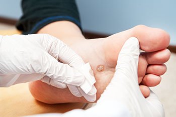 Sore spot on hotsell sole of foot