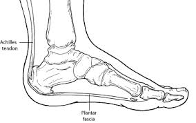 plantar fasciitis or heel pain