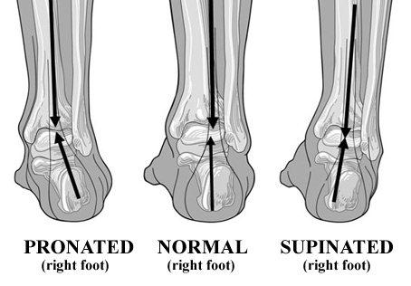 pronated supinated foot