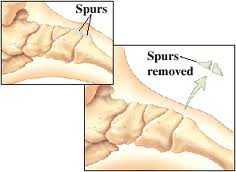 spurs 2