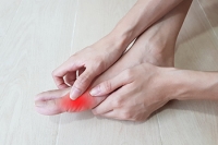 Can Gout Be Prevented?