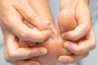 Athlete’s Foot Facts